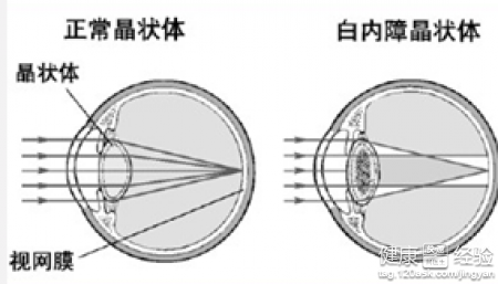 第2步