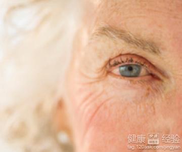 老年性白內障患者需要注意什麼