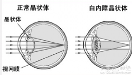 第1步