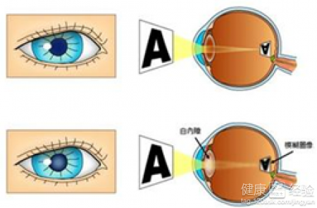 第3步