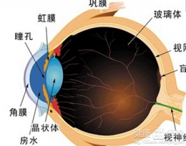 滴眼藥水可以治療白內障嗎?