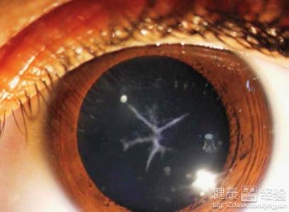 第1步