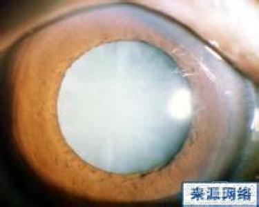 第2步