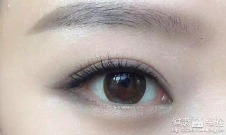 白內障的症狀都有什麼？