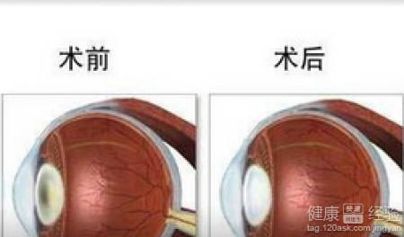 第1步