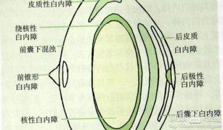 第2步