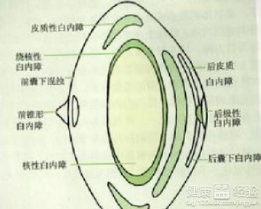 預防白內障出現有講究