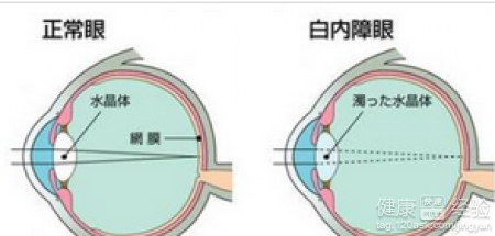 第1步