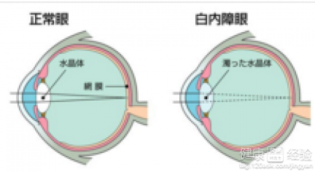 第2步