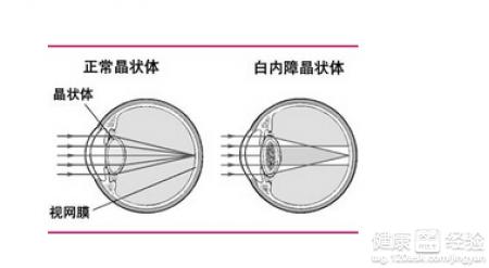 第1步