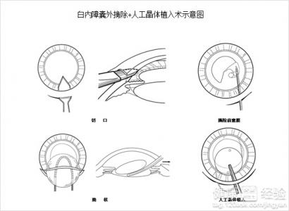 第1步