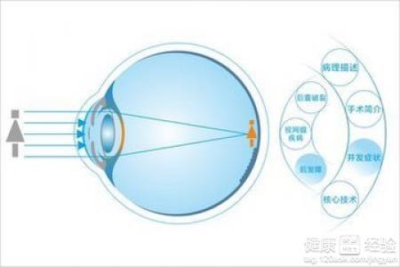 白內障的防治方法