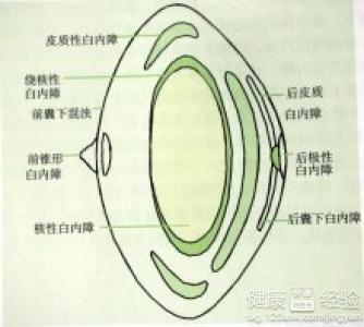 第1步