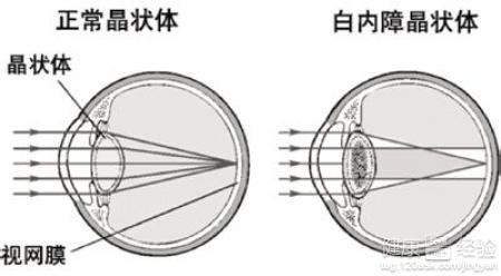 第1步