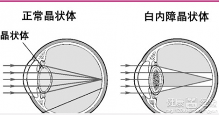 第2步