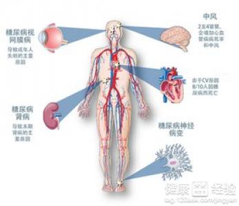 患有糖尿病的老人能用針劑治療白內障嗎