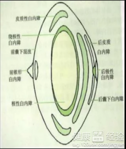 第1步