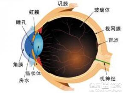 糖尿病導致的白內障該如何治療