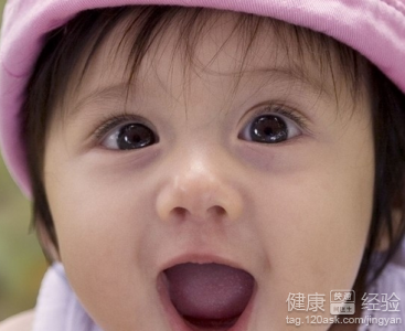 兒童先天性白內障日常生活中應注意的問題
