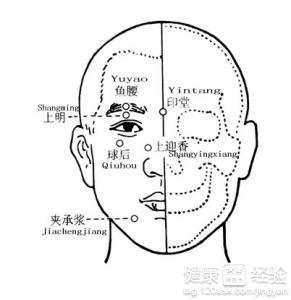 第2步