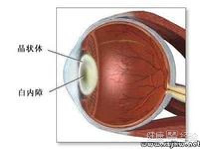 白內障患者術後的營養補給