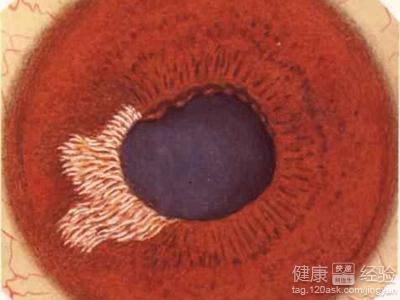 第1步