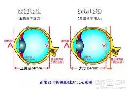 第2步