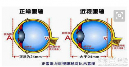 第2步