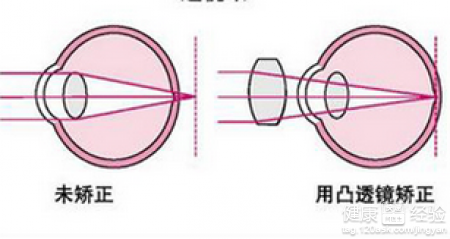 第1步