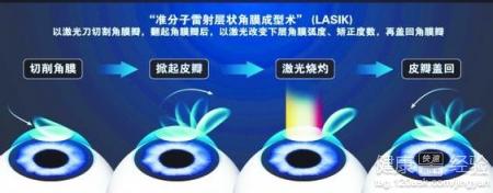 第1步
