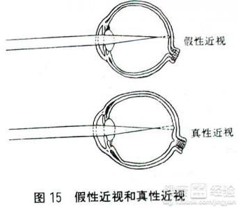 第2步