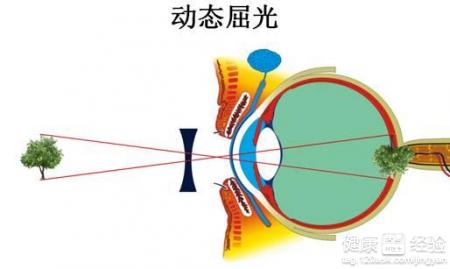 高科技眼鏡並不能根治近視