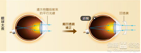 第1步