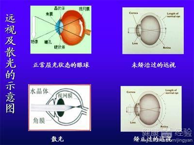 第1步