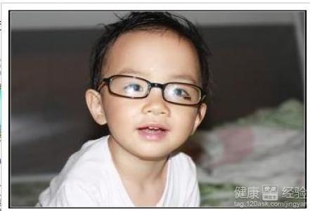 怎樣可以預防孩子近視眼