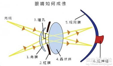 如何分辨遠視眼和老花眼遠視眼常見的5大症狀