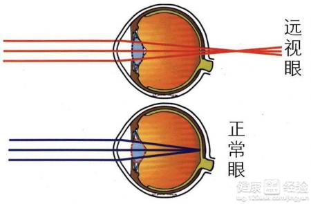 第1步