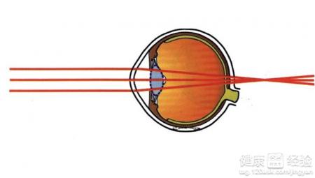 預防遠視眼的十種方法