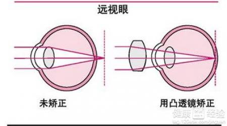 第1步