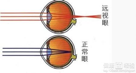 第1步