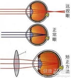 第3步