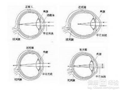 缺乏某種營養才造成兒童先天性遠視眼嗎