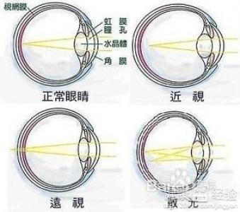 第1步