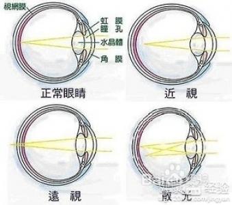 遠視眼和近視眼的近度分別是多少