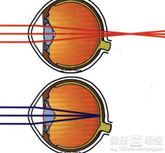遠視眼的視力變化是怎樣的