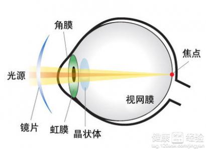 哪些自然方法可以治療遠視眼