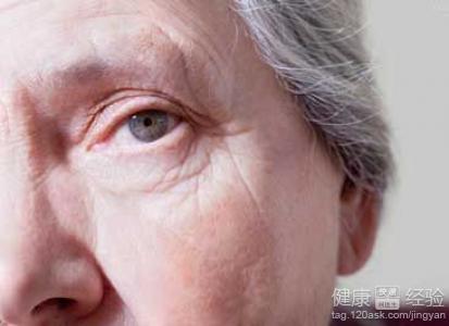 老人患有遠視眼帶白內障要什麼治愈