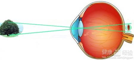 先天性遠視眼平常飲食上吃些什麼比較好