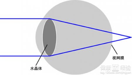 遠視眼戴眼鏡感覺發暈是怎麼回事
