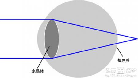 遠視眼戴眼鏡感覺發暈是怎麼回事